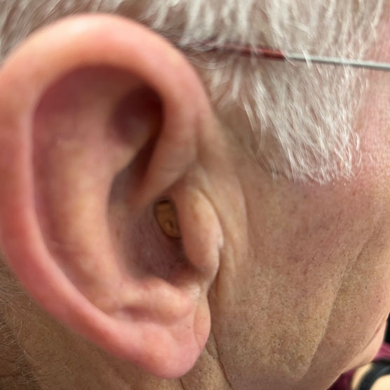 Unique solutions for all hearing loss problems across Leicestershire (Hearing Aids)