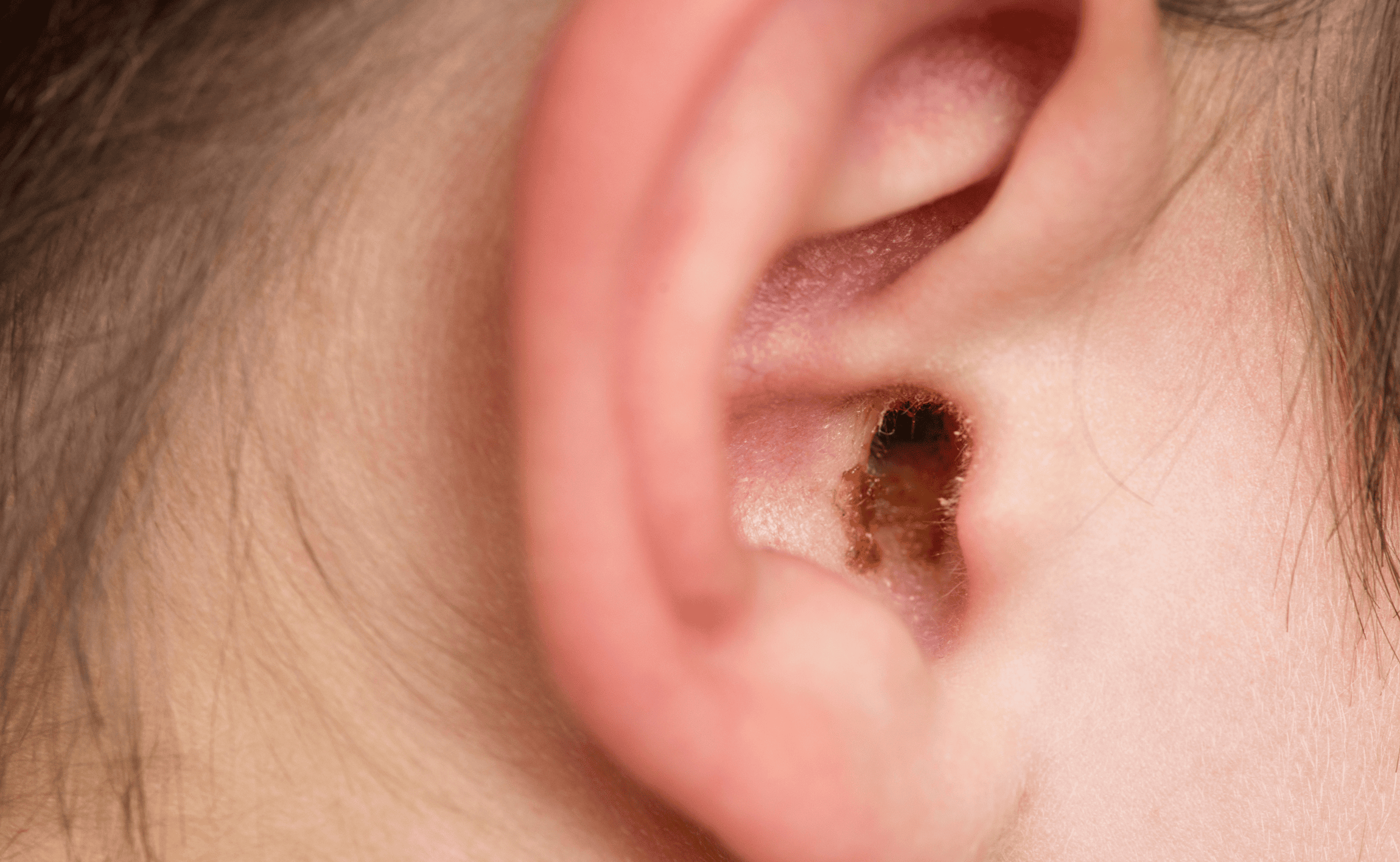 Earwax, Charnwood Hearing Centre Earwax, Charnwood Hearing Centre